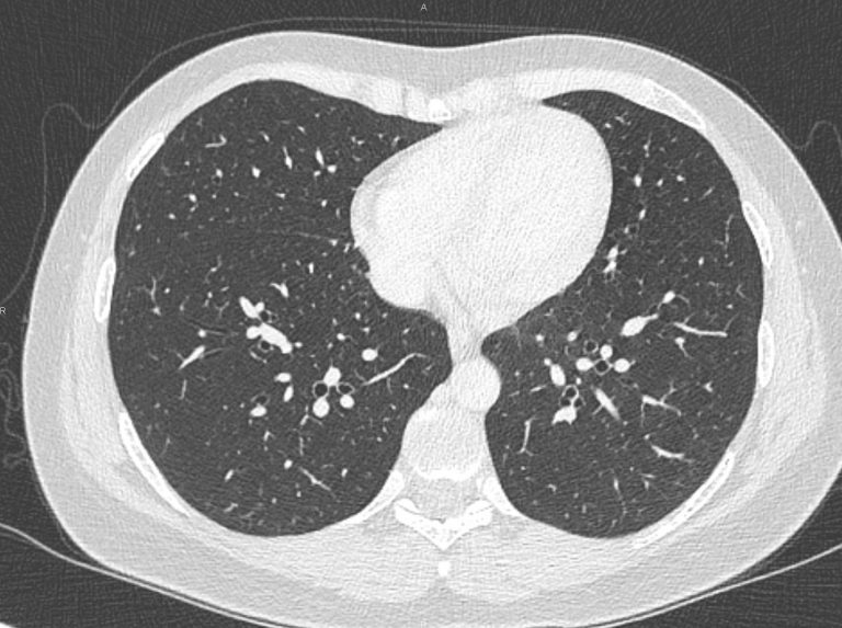 Angers Radiologie Fr Je Visualise Mes Examens